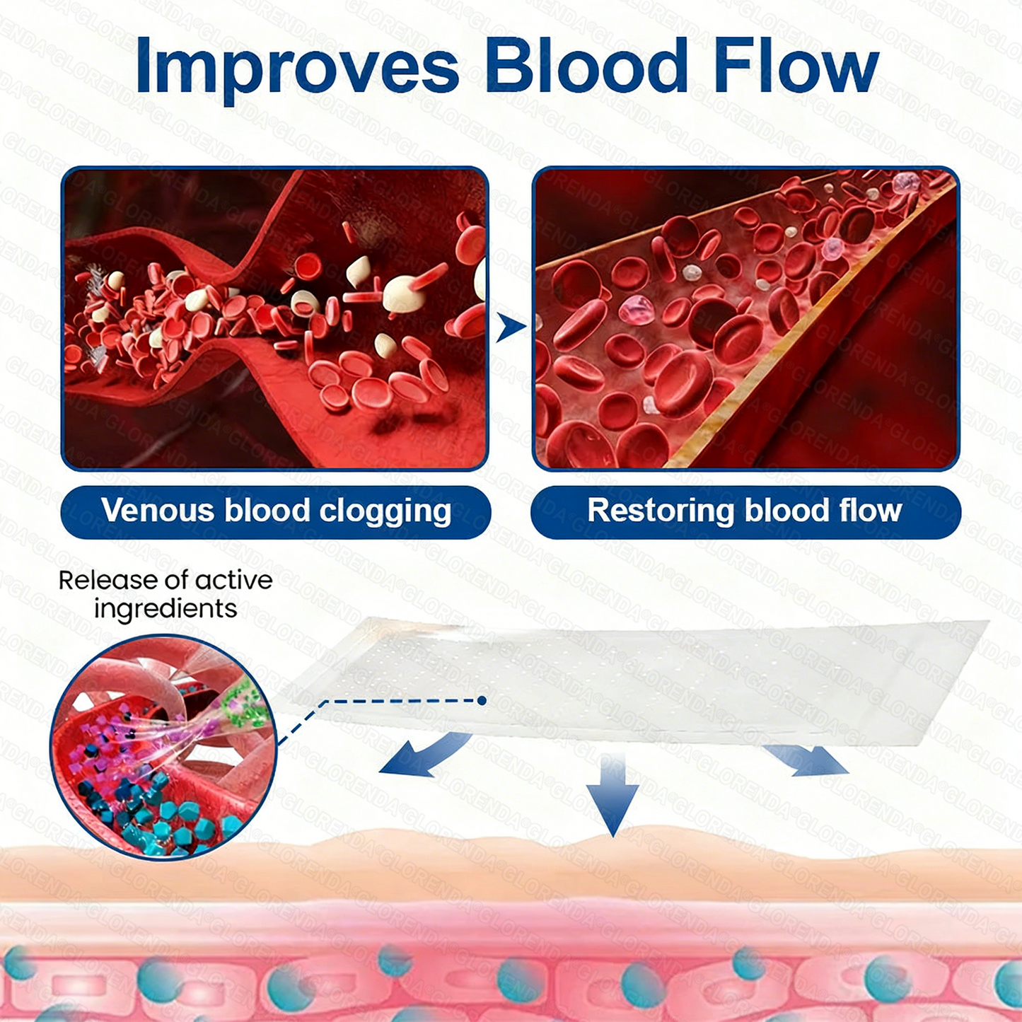 👨‍⚕️🛡️𝐆𝑳𝑶𝗥𝙀𝙉𝐃𝑨® 𝑽𝗲𝗶𝙣 𝘾𝐨𝐧𝘁𝗼𝙪𝙧 𝙈𝙞𝐜𝐫𝒐𝒏𝒆𝗲𝗱𝗹𝙚 𝙋𝙖𝐭𝐜𝒉 𝒘𝒊𝘁𝗵 𝗔𝙙𝙫𝙖𝙣𝙘𝐞𝐝 𝐃𝒊𝒐𝒔𝗺𝙞𝐧 & 𝑯𝒆𝘀𝗽𝗲𝙧𝙞𝙙𝙞𝐧 𝐃𝒆𝒍𝒊𝒗𝗲𝗿𝙮🌿𝟕-𝐃𝐚𝐲 𝐕𝐢𝐬𝐢𝐛𝐥𝐞 𝐑𝐞𝐬𝐮𝐥𝐭𝐬 𝐟𝐨𝐫 𝐕𝐚𝐫𝐢𝐜𝐨𝐬𝐞 𝐕𝐞𝐢𝐧𝐬 — 𝗔𝗱𝘃𝗮𝗻𝗰𝗲𝗱 𝗛𝗲𝗿𝗯𝗮𝗹 𝗕𝗹𝗲𝗻𝗱 𝗧𝗮𝗿𝗴𝗲𝘁𝘀 𝗦𝗽𝗶𝗱𝗲𝗿 𝗩𝗲𝗶𝗻𝘀 & 𝗥𝗲𝗹𝗶𝗲𝘃𝗲𝘀 𝗛𝗲𝗮𝘃𝘆, 𝗧𝗶𝗿𝗲𝗱 𝗟𝗲𝗴𝘀