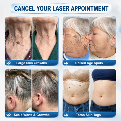 𝐏𝐡𝐚𝐫𝐦𝐚𝐜𝐢𝐬𝐭 𝐑𝐞𝐜𝐨𝐦𝐦𝐞𝐧𝐝𝐞𝐝 ✅𝑯𝗲𝙖𝐥𝒓𝗶𝙯𝗲® 7-𝐷𝑎𝑦 𝗧𝐚𝐠 & 𝗦𝗽𝐨𝐭 𝐄𝐫𝒂𝒔𝒆𝒓🪄(Zero 𝐏𝐚𝐢𝐧, Zero 𝐒𝐜𝐚𝒓𝒔 Rollerball)👩‍⚕️