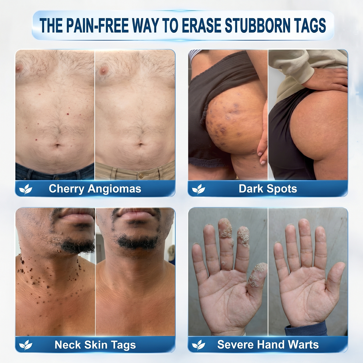𝐏𝐡𝐚𝐫𝐦𝐚𝐜𝐢𝐬𝐭 𝐑𝐞𝐜𝐨𝐦𝐦𝐞𝐧𝐝𝐞𝐝 ✅𝑯𝗲𝙖𝐥𝒓𝗶𝙯𝗲® 7-𝐷𝑎𝑦 𝗧𝐚𝐠 & 𝗦𝗽𝐨𝐭 𝐄𝐫𝒂𝒔𝒆𝒓🪄(Zero 𝐏𝐚𝐢𝐧, Zero 𝐒𝐜𝐚𝒓𝒔 Rollerball)👩‍⚕️