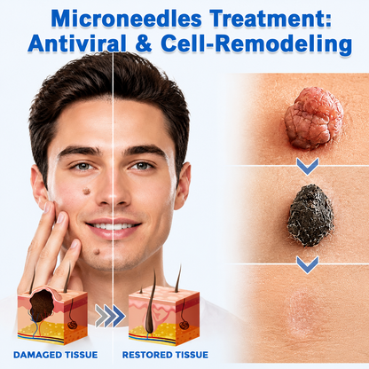 ✨✨𝐏𝑬𝗔𝙍𝙇𝐌𝑶𝗢𝙉®2-in-1 Microneedle & Hydrocolloid Patch🍀| Removes Raised Moles, Acne, Flat Warts & Skin Tags | Helps Improve Wrinkles, Scars & Blemishes | Invisible Patches for Face & Body