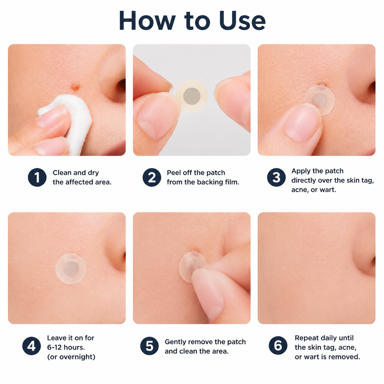 ✨✨𝐏𝑬𝗔𝙍𝙇𝐌𝑶𝗢𝙉®2-in-1 Microneedle & Hydrocolloid Patch🍀| Removes Raised Moles, Acne, Flat Warts & Skin Tags | Helps Improve Wrinkles, Scars & Blemishes | Invisible Patches for Face & Body