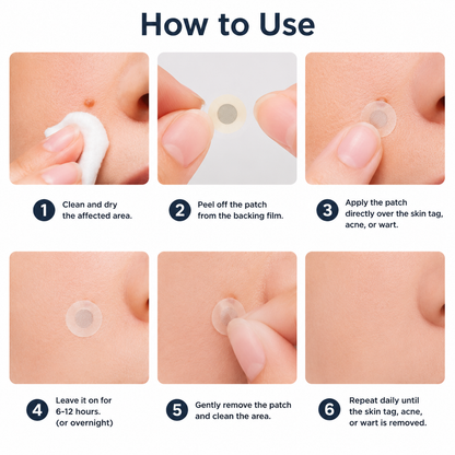 ✨✨𝐏𝑬𝗔𝙍𝙇𝐌𝑶𝗢𝙉®2-in-1 Microneedle & Hydrocolloid Patch🍀| Removes Raised Moles, Acne, Flat Warts & Skin Tags | Helps Improve Wrinkles, Scars & Blemishes | Invisible Patches for Face & Body