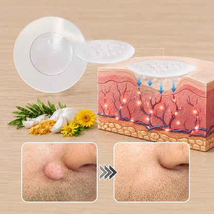 ✨✨𝐏𝑬𝗔𝙍𝙇𝐌𝑶𝗢𝙉®2-in-1 Microneedle & Hydrocolloid Patch🍀| Removes Raised Moles, Acne, Flat Warts & Skin Tags | Helps Improve Wrinkles, Scars & Blemishes | Invisible Patches for Face & Body