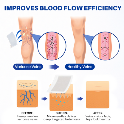 👨‍⚕️🛡️𝐆𝑳𝑶𝗥𝙀𝙉𝐃𝑨® 𝑽𝗲𝗶𝙣 𝘾𝐨𝐧𝘁𝗼𝙪𝙧 𝙈𝙞𝐜𝐫𝒐𝒏𝒆𝗲𝗱𝗹𝙚 𝙋𝙖𝐭𝐜𝒉 𝒘𝒊𝘁𝗵 𝗔𝙙𝙫𝙖𝙣𝙘𝐞𝐝 𝐃𝒊𝒐𝒔𝗺𝙞𝐧 & 𝑯𝒆𝘀𝗽𝗲𝙧𝙞𝙙𝙞𝐧 𝐃𝒆𝒍𝒊𝒗𝗲𝗿𝙮🌿𝟕-𝐃𝐚𝐲 𝐕𝐢𝐬𝐢𝐛𝐥𝐞 𝐑𝐞𝐬𝐮𝐥𝐭𝐬 𝐟𝐨𝐫 𝐕𝐚𝐫𝐢𝐜𝐨𝐬𝐞 𝐕𝐞𝐢𝐧𝐬 — 𝗔𝗱𝘃𝗮𝗻𝗰𝗲𝗱 𝗛𝗲𝗿𝗯𝗮𝗹 𝗕𝗹𝗲𝗻𝗱 𝗧𝗮𝗿𝗴𝗲𝘁𝘀 𝗦𝗽𝗶𝗱𝗲𝗿 𝗩𝗲𝗶𝗻𝘀 & 𝗥𝗲𝗹𝗶𝗲𝘃𝗲𝘀 𝗛𝗲𝗮𝘃𝘆, 𝗧𝗶𝗿𝗲𝗱 𝗟𝗲𝗴𝘀